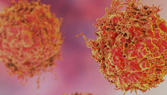 Advancing Hope for Prostate Cancer Patients