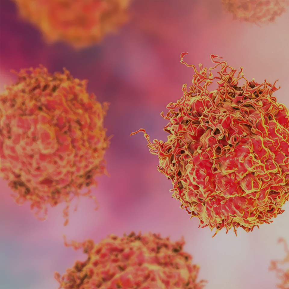 Advancing Hope for Prostate Cancer Patients